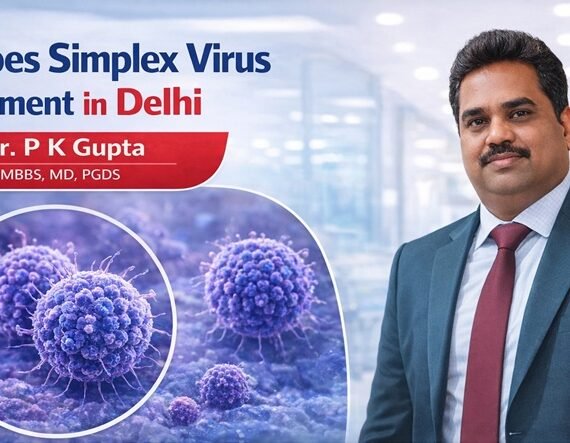 Herpes Simplex Virus Treatment in Delhi