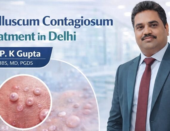 Molluscum Contagiosum Treatment in Delhi