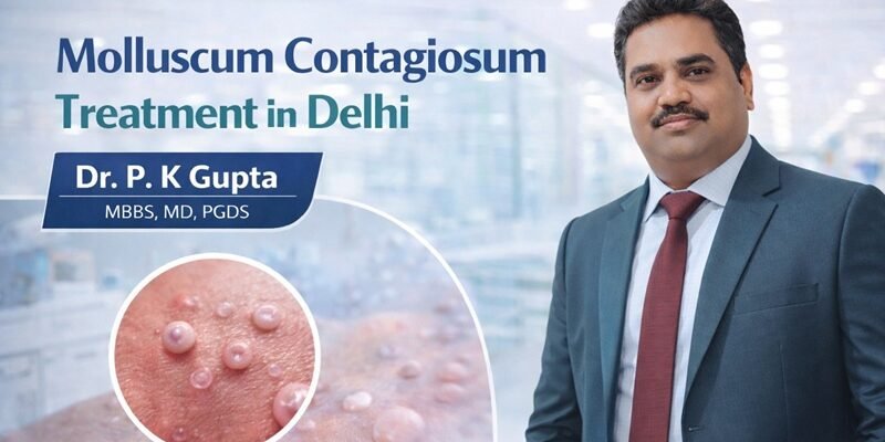 Molluscum Contagiosum Treatment in Delhi