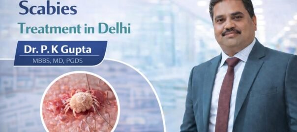Scabies Treatment in Delhi
